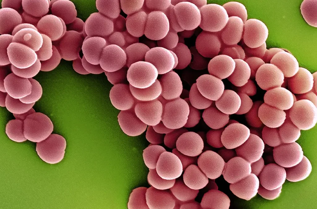 Electron micrograph of methicillin-resistant Staphylococcus aureus (MRSA), a drug-resistant superbug