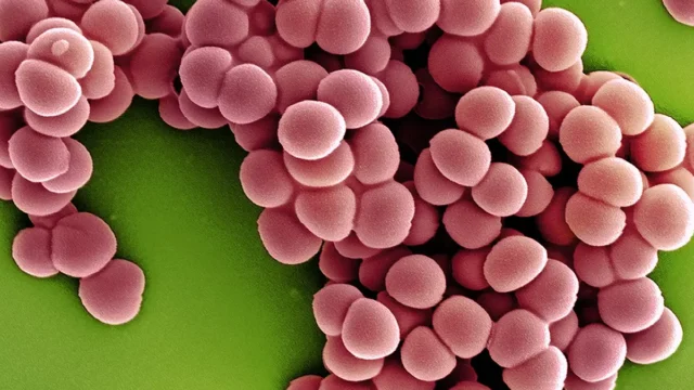 Electron micrograph of methicillin-resistant Staphylococcus aureus (MRSA), a drug-resistant superbug