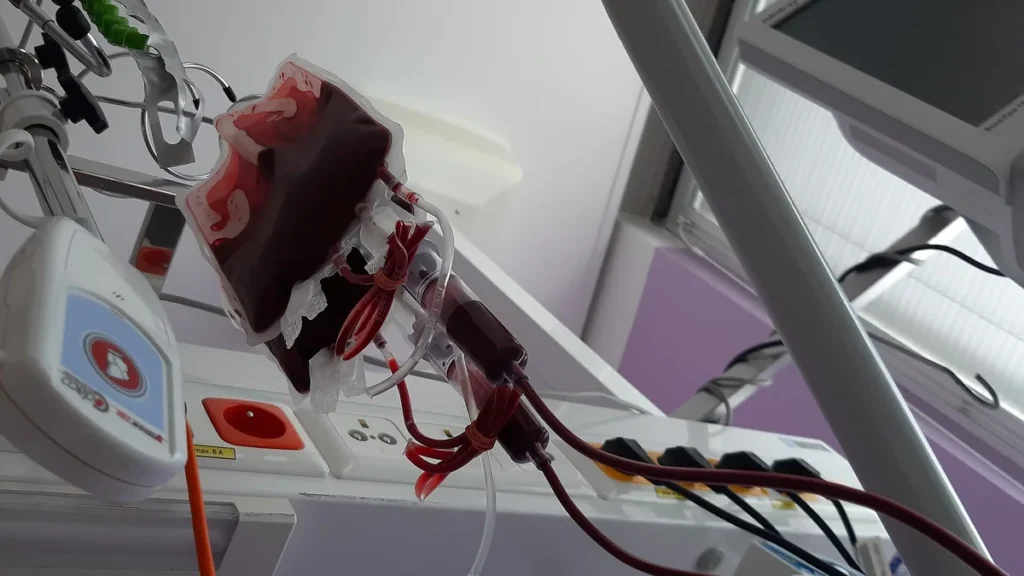 A bag of donated blood connected to tubes on processing equipment