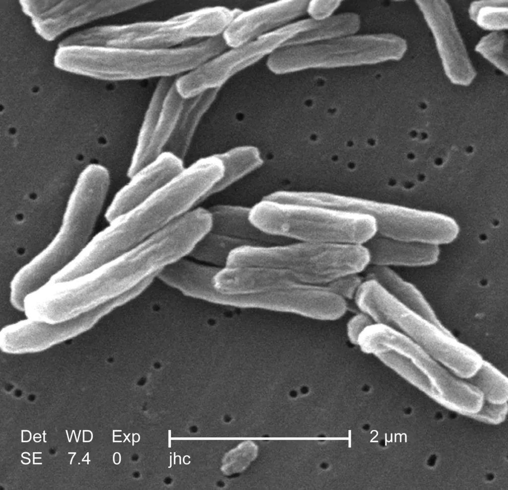 Scanning electron micrograph of Mycobacterium tuberculosis bacteria, which cause TB