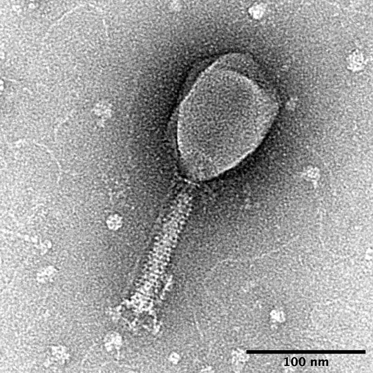 A T 2 bacteriophage, a virus that infects bacteria, seen under an electron microscope