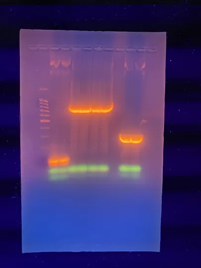 DNA fragments separated by agarose gel electrophoresis, viewed under UV light